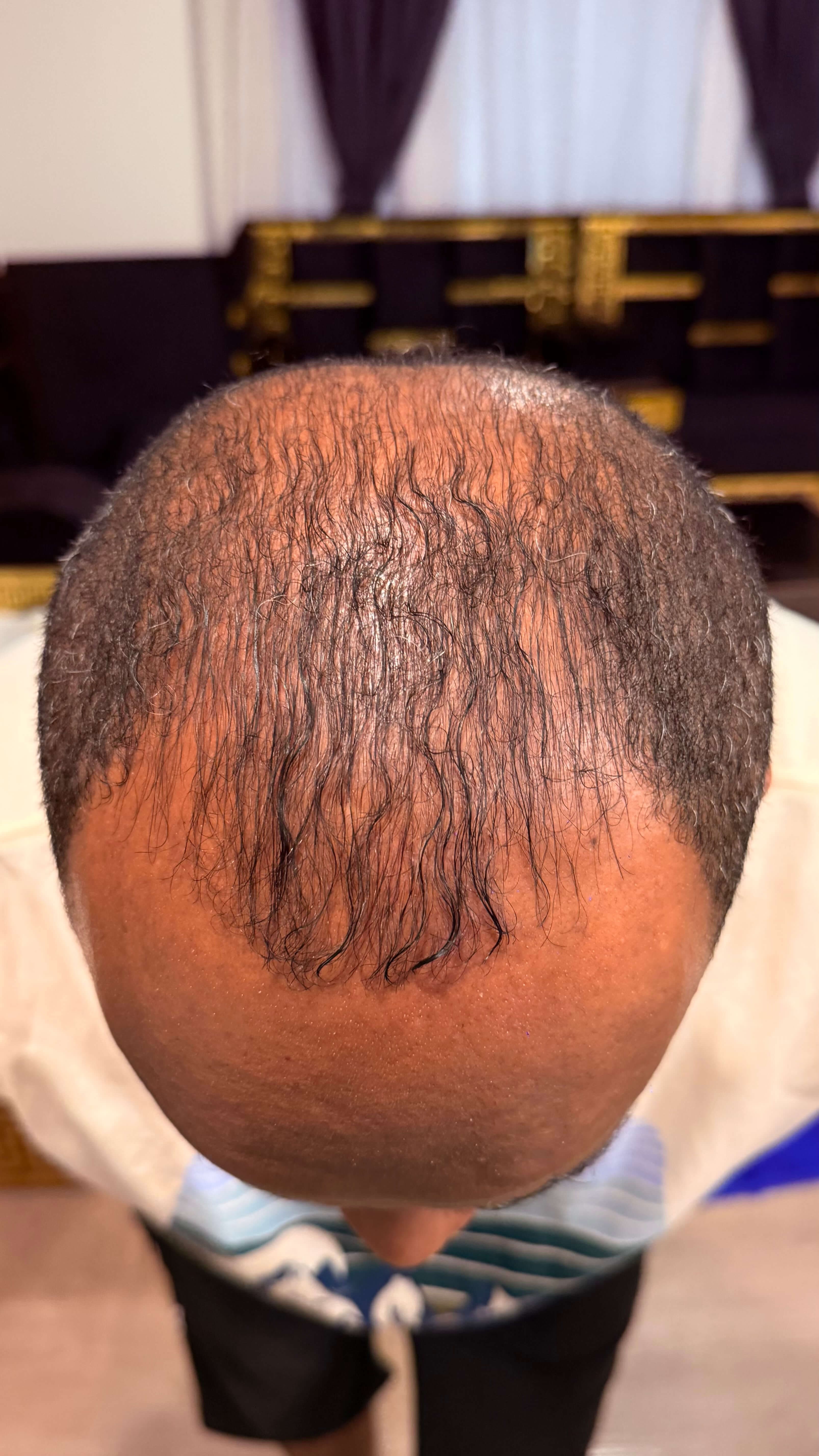 After using ReviveStrand